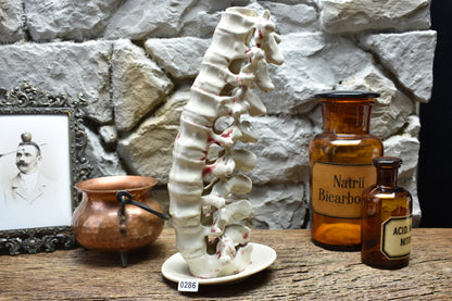 Spine candle holder large white and bloody effect glaze